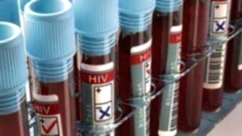 ΕΟΔΥ: 550 νέα κρούσματα HIV το 2024 με αυξημένα ποσοστά ακαθόριστης μόλυνσης